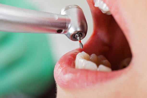 Best Affordable Emergency Dental Care  in Mclean, TX